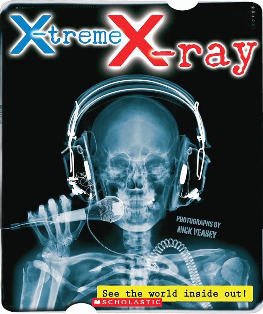 X-treme X-ray: See the World Inside Out!: See The World Inside Out! cover image
